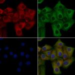 OR10T2 Polyclonal Antibody