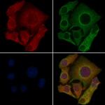OR1B1 Antibody in Immunocytochemistry (ICC/IF)