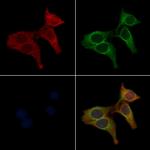 OR2B2 Polyclonal Antibody