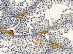 OR2B8P Polyclonal Antibody