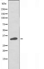 OR2I1P Polyclonal Antibody