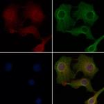 OR2M2 Polyclonal Antibody