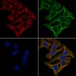 OR2M7 Polyclonal Antibody