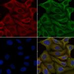 OR4A15 Polyclonal Antibody