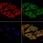 OR4A4/OR4A47 Polyclonal Antibody