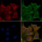 OR4D6 Polyclonal Antibody