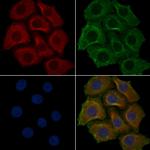 OR4F4 Polyclonal Antibody