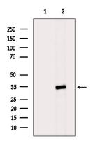 OR4F6 Polyclonal Antibody