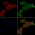 OR51A7 Polyclonal Antibody