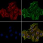 OR51D1 Polyclonal Antibody