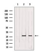 OR5D3 Polyclonal Antibody