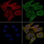 OR5F1 Polyclonal Antibody