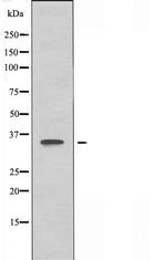 OR5F1 Antibody in Western Blot (WB)