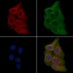 OR5M11 Polyclonal Antibody