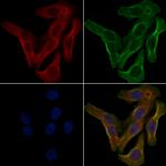 OR5W2 Polyclonal Antibody