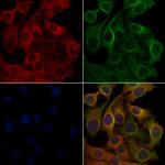 OR6K2 Polyclonal Antibody