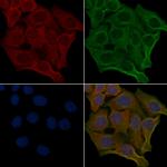 OR6S1 Polyclonal Antibody