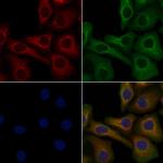 OR6T1 Polyclonal Antibody