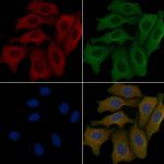 OR4K14 Polyclonal Antibody