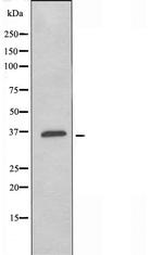OR4K14 Antibody in Western Blot (WB)