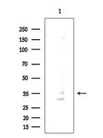 OR4K14 Antibody in Western Blot (WB)
