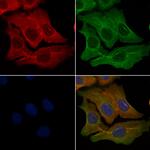 OR9Q2 Polyclonal Antibody