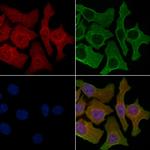 P2Y8 Polyclonal Antibody