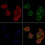 SLC52A2 Polyclonal Antibody