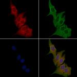 OR7E5P Antibody in Immunocytochemistry (ICC/IF)