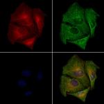 OR7E5P Polyclonal Antibody