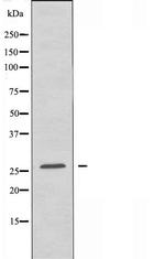 OR7E5P Antibody in Western Blot (WB)