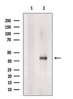 TMEM185A Polyclonal Antibody