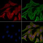 TAS2R5 Polyclonal Antibody