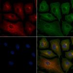 VN1R2 Polyclonal Antibody