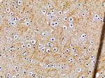 OR10G7 Polyclonal Antibody