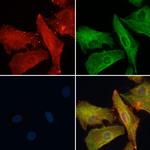 OR51B5 Polyclonal Antibody