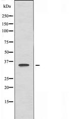 OR51B6 Polyclonal Antibody