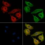 OR51H1P Polyclonal Antibody