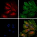 OR2F2 Polyclonal Antibody