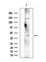 OR2F2 Antibody in Western Blot (WB)