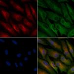 OR51A4 Polyclonal Antibody