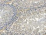 OR5A1 Antibody in Immunohistochemistry (Paraffin) (IHC (P))