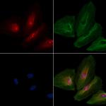 OR8B4 Polyclonal Antibody