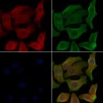 OR8G2 Polyclonal Antibody