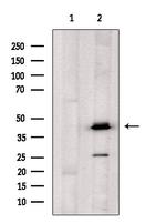 OXER1 Polyclonal Antibody