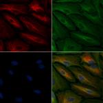 TAS2R45 Antibody in Immunocytochemistry (ICC/IF)