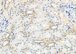 Perforin Polyclonal Antibody