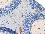 BVES Polyclonal Antibody