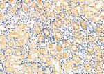 MTM1 Polyclonal Antibody