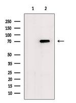 MTM1 Antibody in Western Blot (WB)